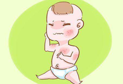 嬰兒喝母乳起濕疹是怎麽回事 嬰兒喝母乳起濕疹是怎麽回事